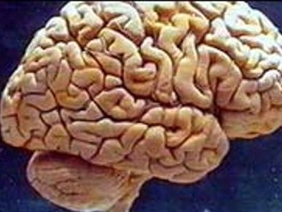  Novi trag u otkrivanju uzroka Alzheimera