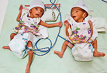 Indijka rodila blizance u 71. godini života
