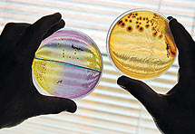 Sta su mikroorganizmi i kako nastaje bolest?