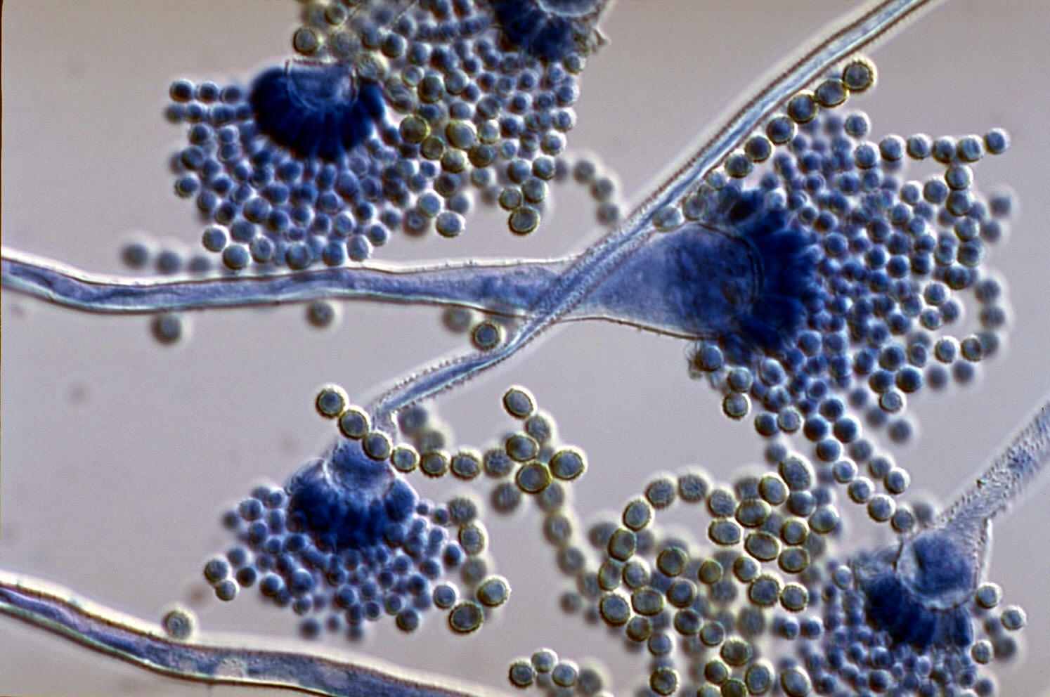 Aspergillus flavus