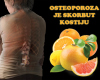 Osteoporoza je skorbut kostiju!