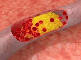 Namirnice koje rešavaju zakrčenja arterija i masnoću u krvi