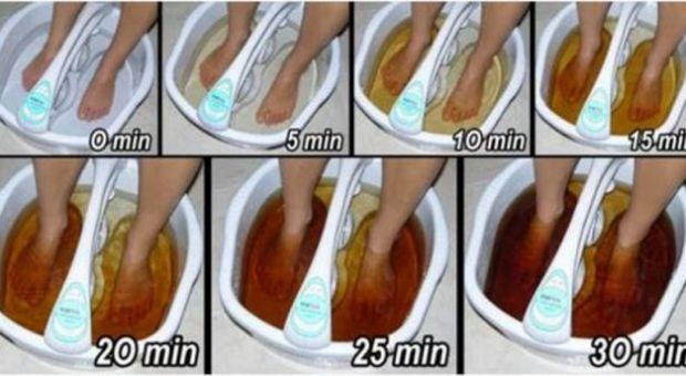 Savjeti: Napravite detoksifikaciju i izbacite otrov kroz stopala