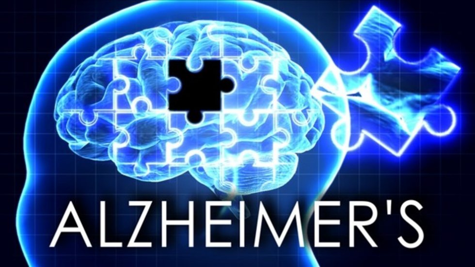 Drago Plečko: Rješavanjem sudokua protiv Alzheimera