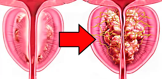 PROSTATA : Četvrti (4.-L.) - Lumbalni križni kičmeni kralježak,..