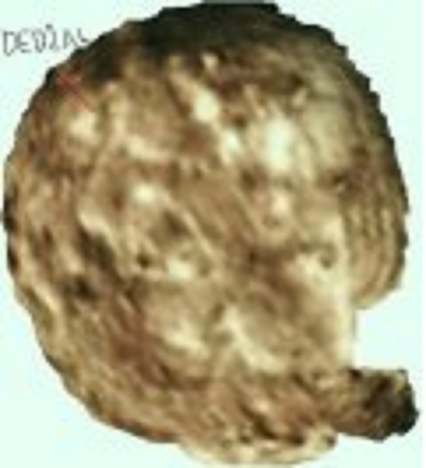 Dedždžal (Antikrist) je otkriven