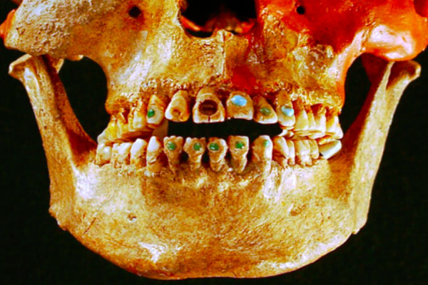 Maje ugrađivale ukrase na zube