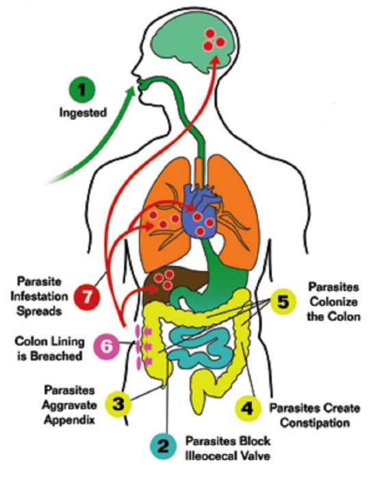 Antiparazitni program