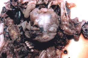 glava abortiranog djeteta