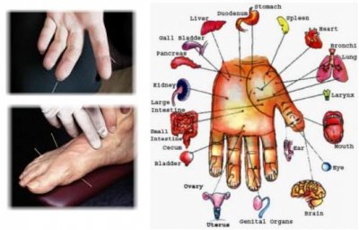 Su Jok terapija-medicina 21. stoljeća